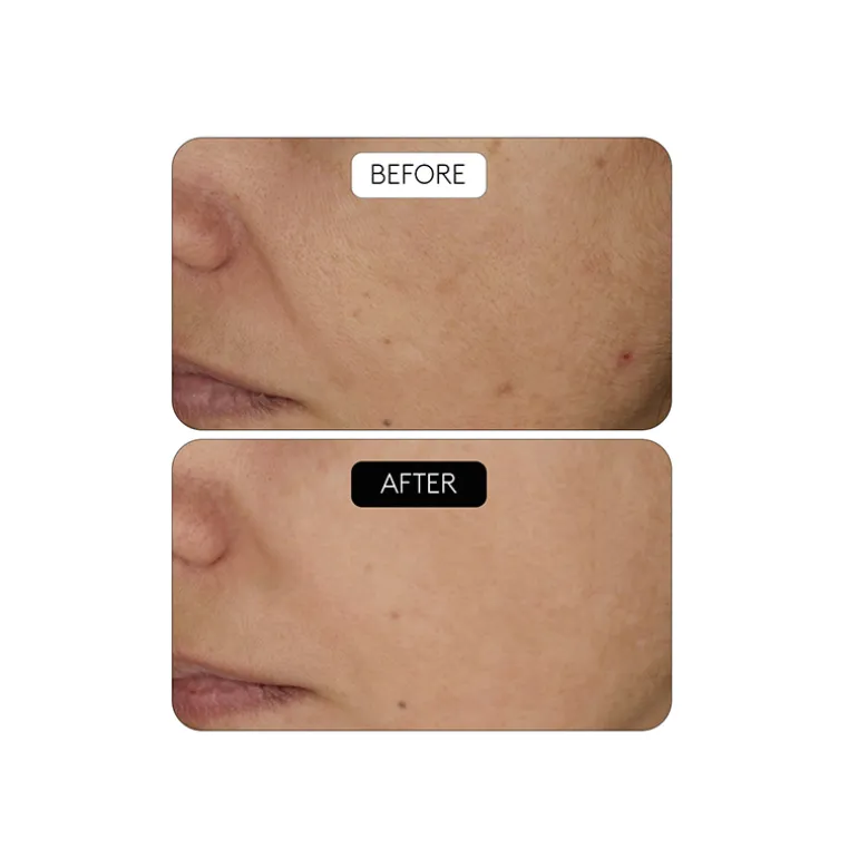 Clinical Beauty Filler