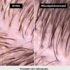 SCALP ADVANCED ANTI-OILINESS 2-IN-1