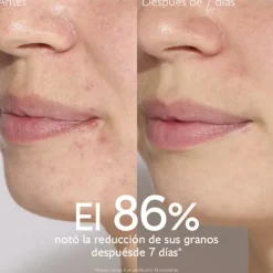 Vinopure Sérum con Acido Salicílico Anti-imperfecciones